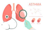 Asthma
