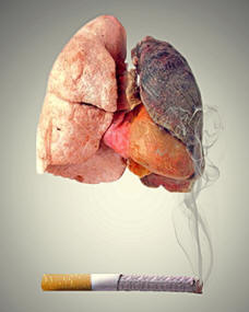 Human lung with a cigarette