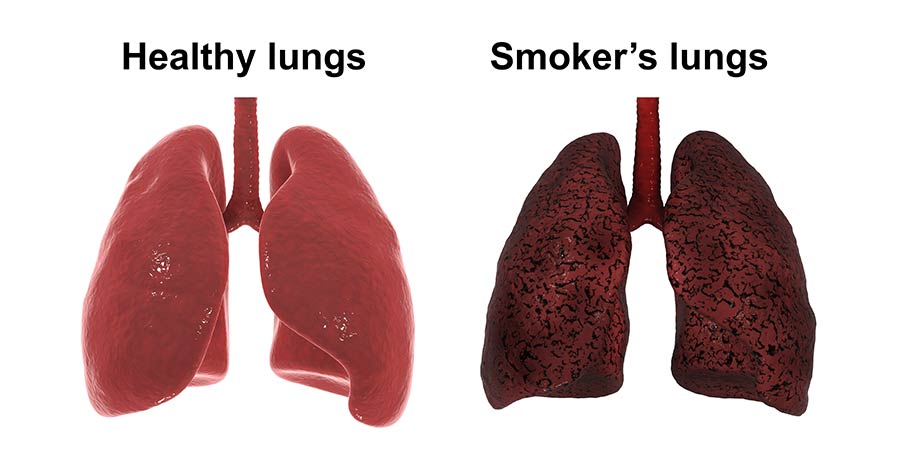 lungs