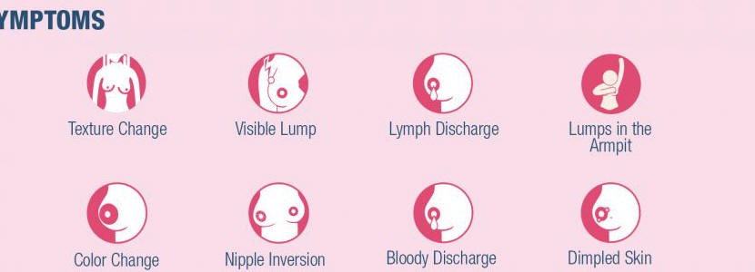 Stages of Breast cancer