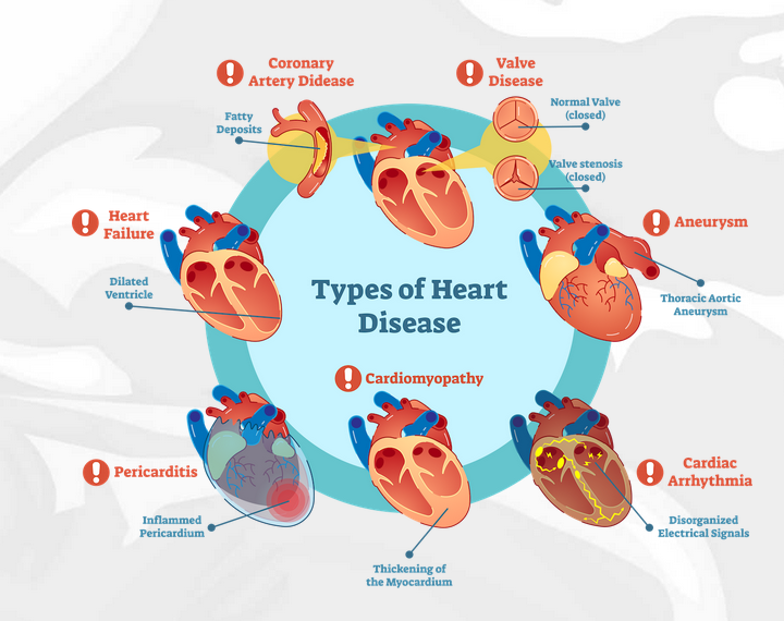 Types of heart Disease
