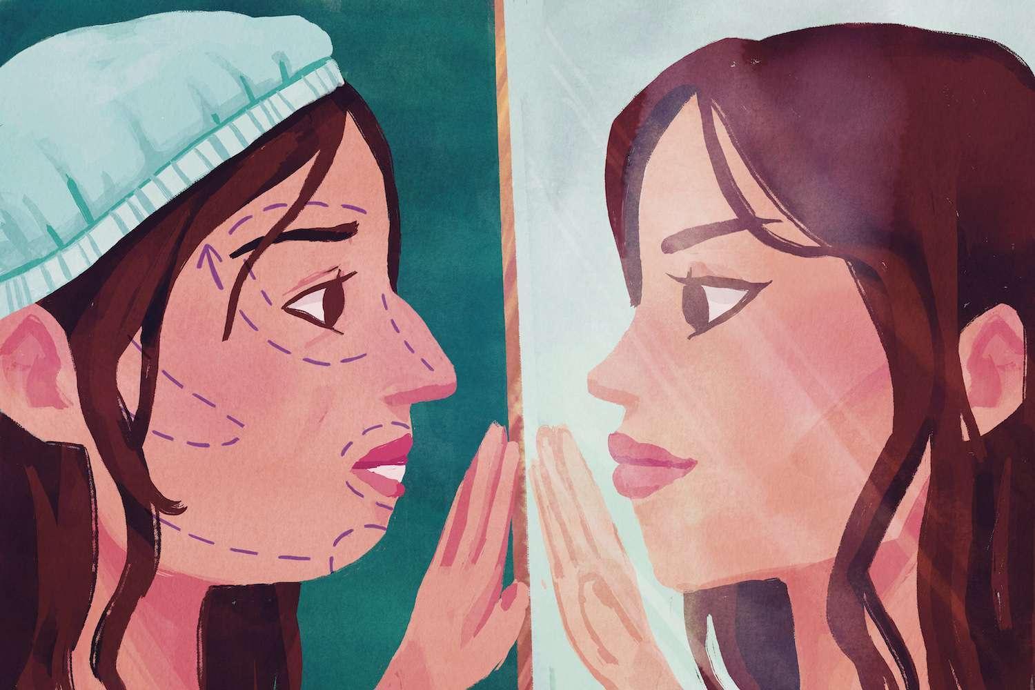 Types of Plastic Surgery Overview