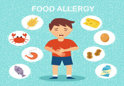 Allergie Food